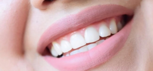 Safe teeth whitening at home