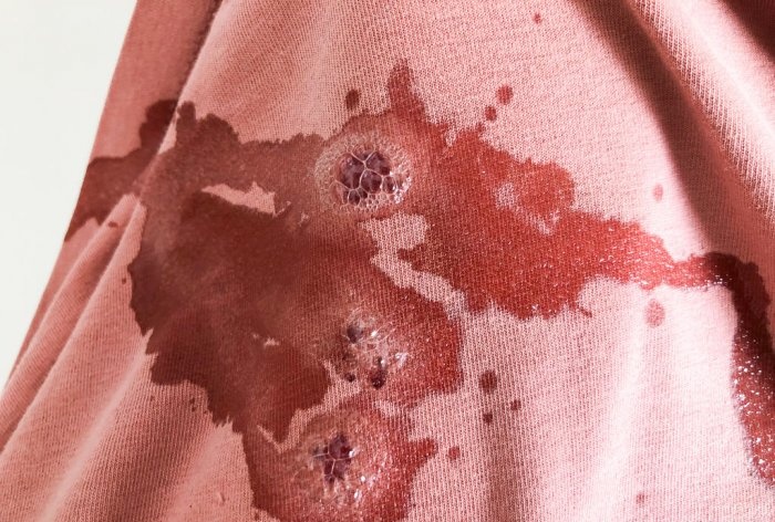 How to remove blood from clothes